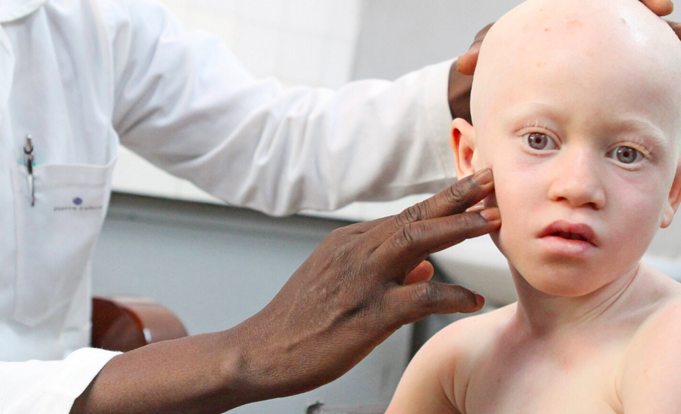 Fondation Pierre Fabre dermatologie albinisme